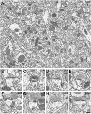 Unambiguous identification of asymmetric and symmetric synapses using volume electron microscopy